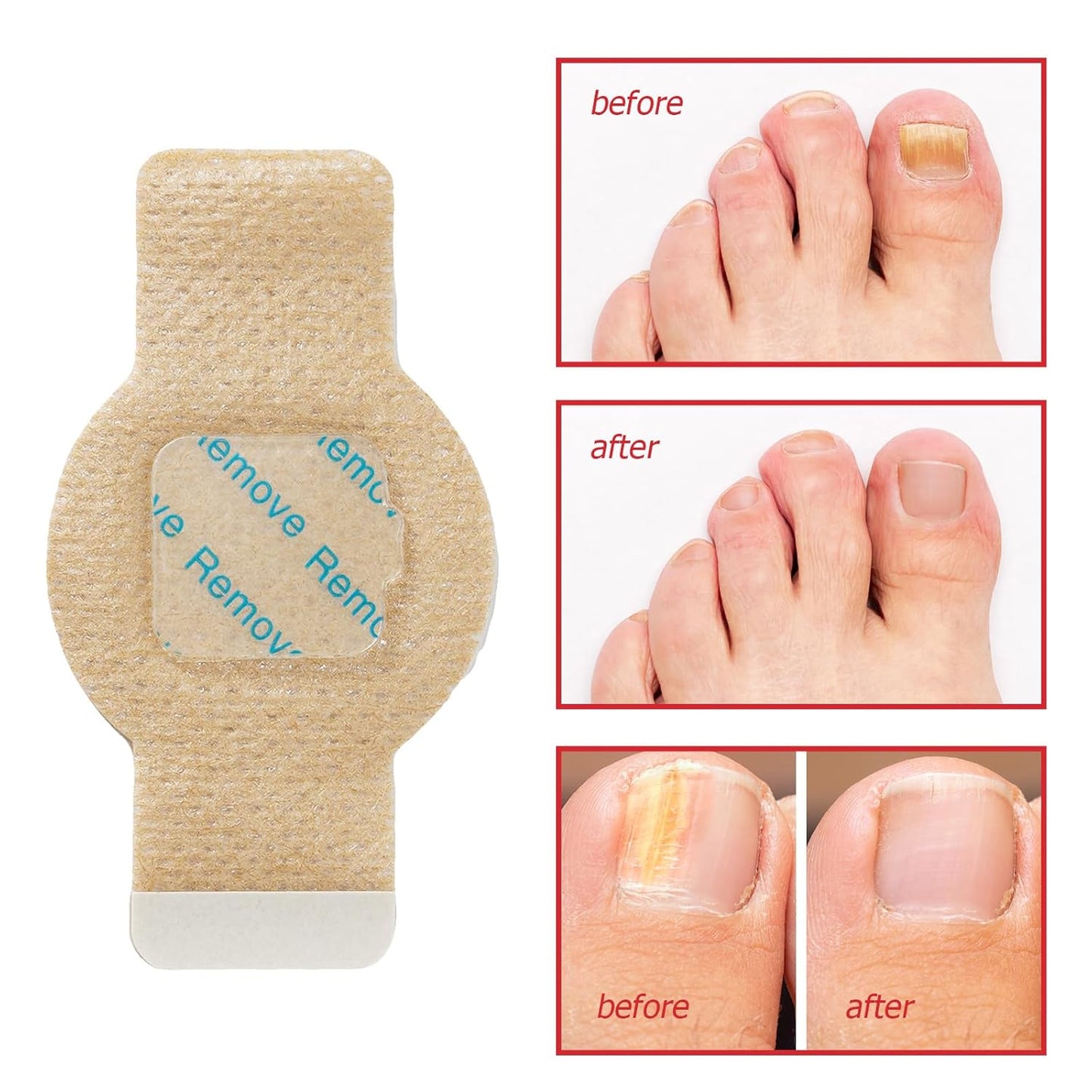 Nail Revival Patches™