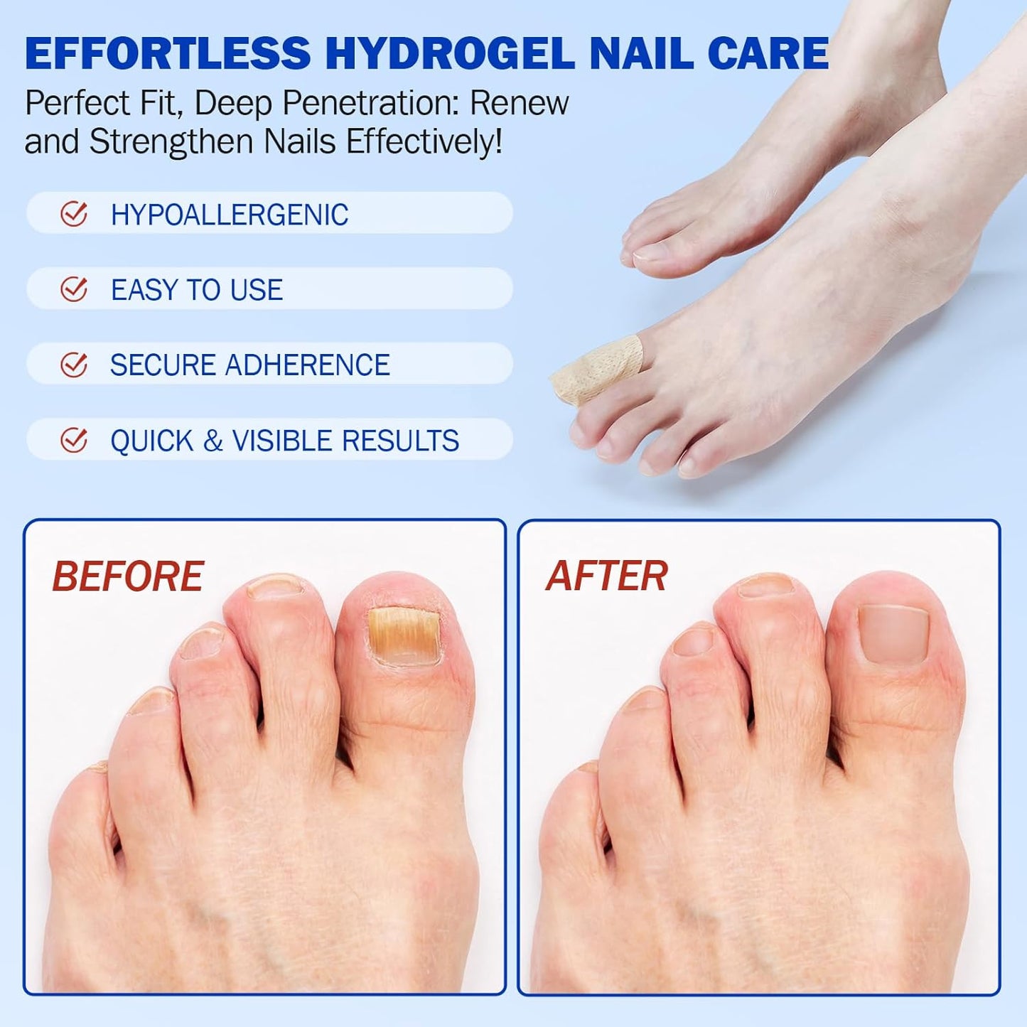 Nail Revival Patches™