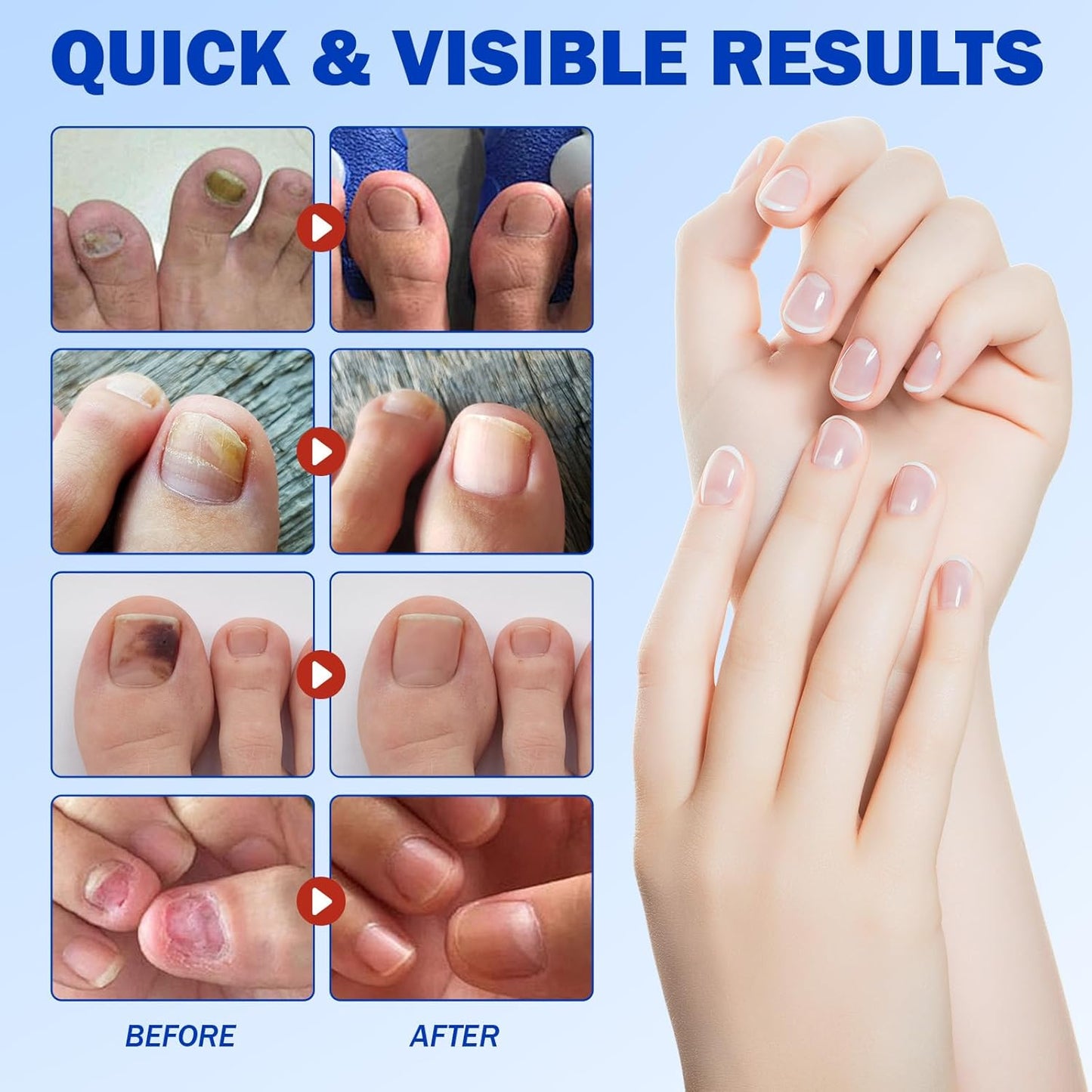 Nail Revival Patches™