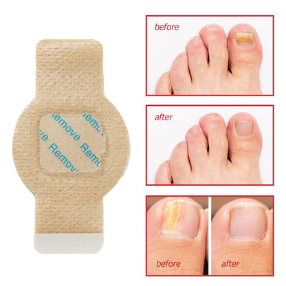 Nail Revival Patches™