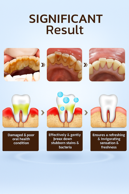 Niacinamide Whitening Toothpaste