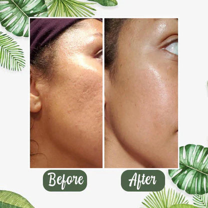Green Tea Deep Cleanse Mask™